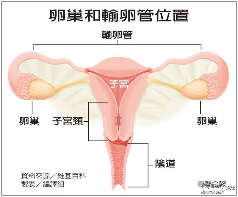 預防性防癌／切卵巢  常見婦科病